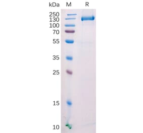 SDS-PAGE - Recombinant Mouse FAP Protein (Fc Tag) (A318209) - Antibodies.com