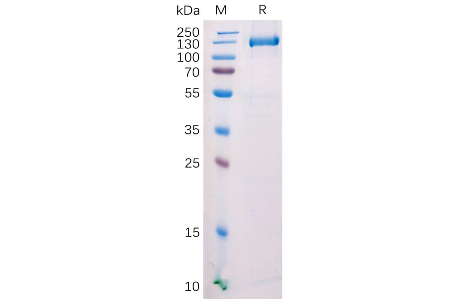SDS-PAGE - Recombinant Mouse FAP Protein (Fc Tag) (A318209) - Antibodies.com