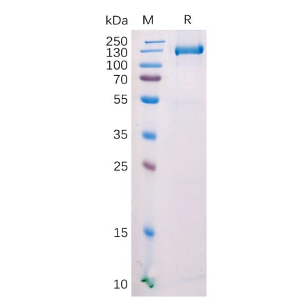 SDS-PAGE - Recombinant Mouse FAP Protein (Fc Tag) (A318209) - Antibodies.com