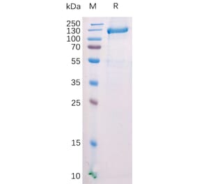 SDS-PAGE - Recombinant Mouse FAP Protein (Fc Tag) (A318210) - Antibodies.com