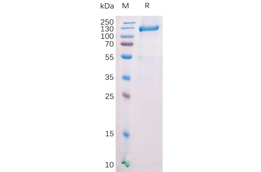 SDS-PAGE - Recombinant Mouse FAP Protein (Fc Tag) (A318210) - Antibodies.com