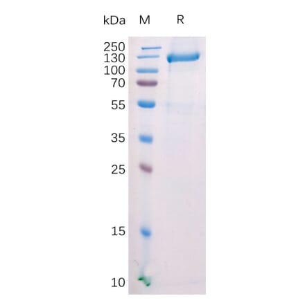 SDS-PAGE - Recombinant Mouse FAP Protein (Fc Tag) (A318210) - Antibodies.com