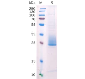 SDS-PAGE - Recombinant Human ANGPTL3 Protein (6×His Tag) (A318211) - Antibodies.com