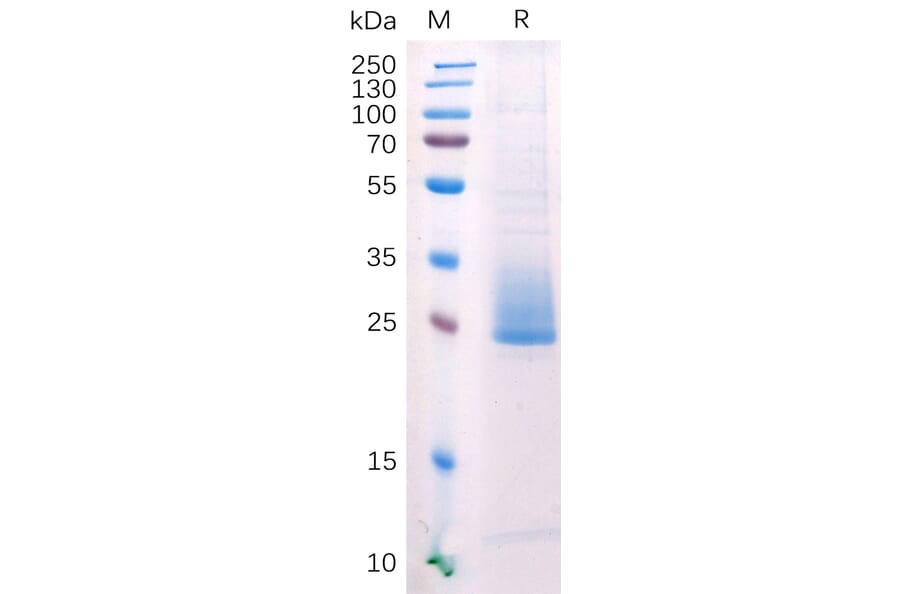 SDS-PAGE - Recombinant Human ANGPTL3 Protein (6×His Tag) (A318211) - Antibodies.com