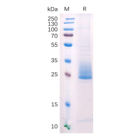 SDS-PAGE - Recombinant Human ANGPTL3 Protein (6×His Tag) (A318211) - Antibodies.com