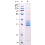 SDS-PAGE - Recombinant Human ANGPTL3 Protein (6×His Tag) (A318211) - Antibodies.com