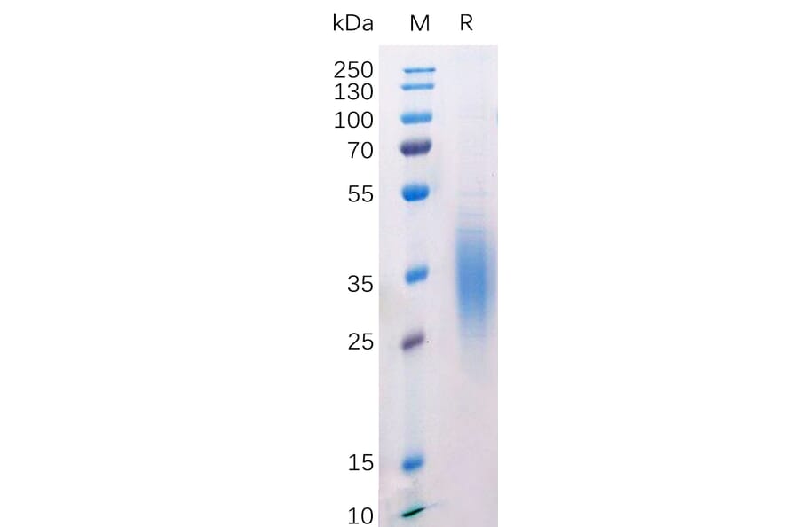 SDS-PAGE - Recombinant Mouse CD272/BTLA Protein (6×His Tag) (A318212) - Antibodies.com