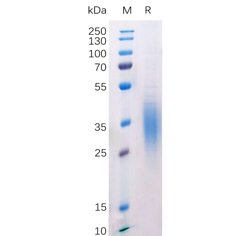 SDS-PAGE - Recombinant Mouse CD272/BTLA Protein (6×His Tag) (A318212) - Antibodies.com