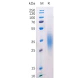 SDS-PAGE - Recombinant Mouse CD272/BTLA Protein (6×His Tag) (A318212) - Antibodies.com