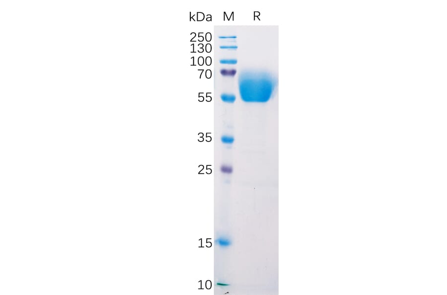 SDS-PAGE - Recombinant Mouse CD272/BTLA Protein (Fc Tag) (A318213) - Antibodies.com