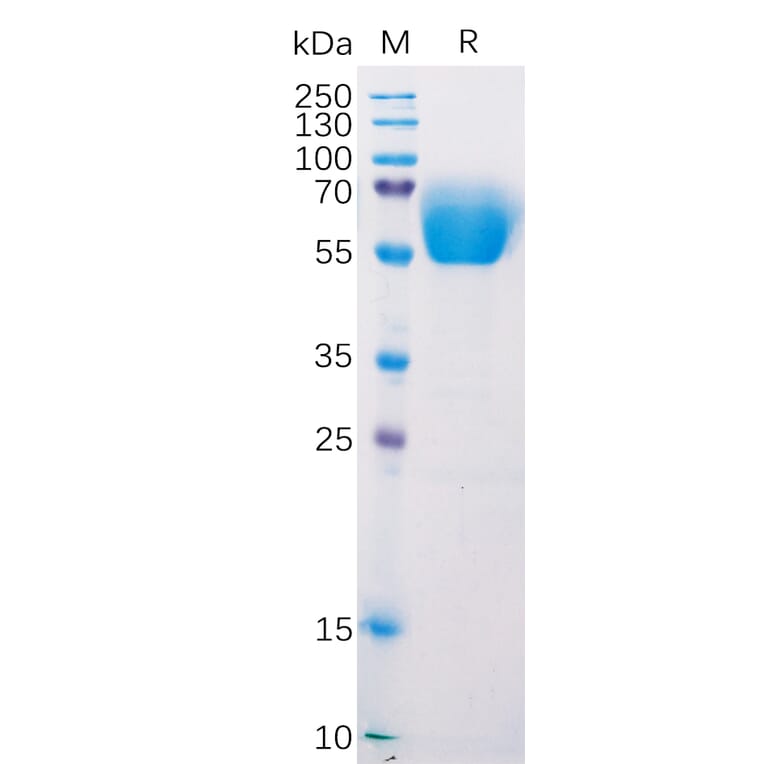SDS-PAGE - Recombinant Mouse CD272/BTLA Protein (Fc Tag) (A318213) - Antibodies.com
