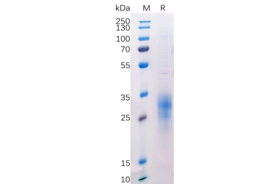 SDS-PAGE - Recombinant Human CD272/BTLA Protein (6×His Tag) (A318214) - Antibodies.com