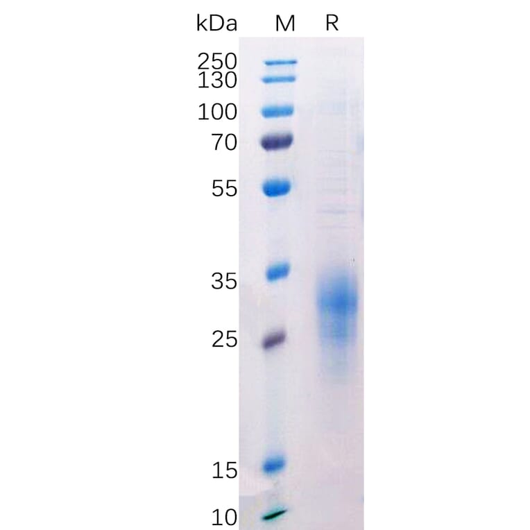 SDS-PAGE - Recombinant Human CD272/BTLA Protein (6×His Tag) (A318214) - Antibodies.com