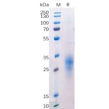 SDS-PAGE - Recombinant Human CD272/BTLA Protein (6×His Tag) (A318214) - Antibodies.com