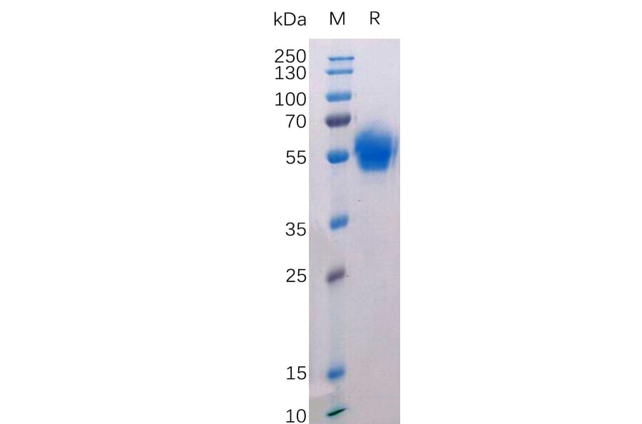 SDS-PAGE - Recombinant Human CD272/BTLA Protein (Fc Tag) (A318215) - Antibodies.com