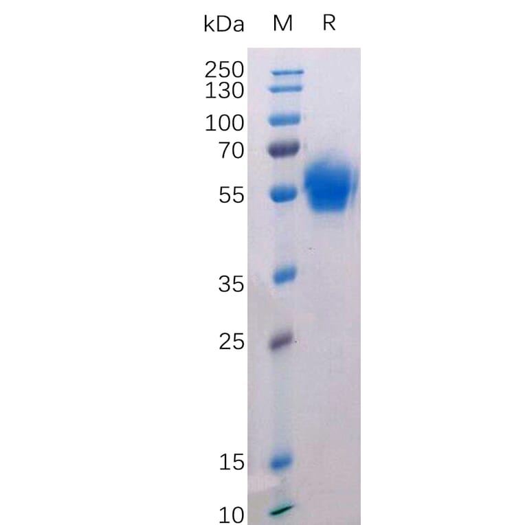 SDS-PAGE - Recombinant Human CD272/BTLA Protein (Fc Tag) (A318215) - Antibodies.com