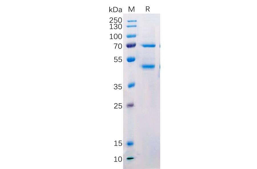 SDS-PAGE - Recombinant Human MASP2 Protein (Fc Tag) (A318216) - Antibodies.com