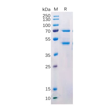 SDS-PAGE - Recombinant Human MASP2 Protein (Fc Tag) (A318216) - Antibodies.com
