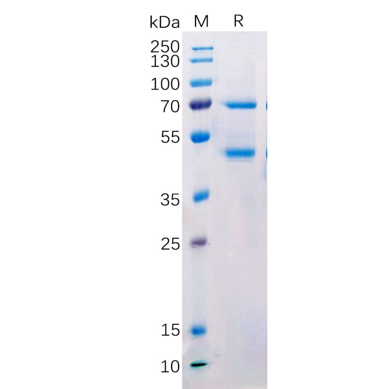 SDS-PAGE - Recombinant Human MASP2 Protein (Fc Tag) (A318216) - Antibodies.com