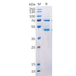 SDS-PAGE - Recombinant Human MASP2 Protein (Fc Tag) (A318216) - Antibodies.com