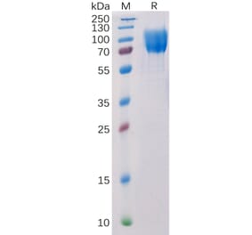 SDS-PAGE - Recombinant Human c-Kit Protein (6×His Tag) (A318217) - Antibodies.com