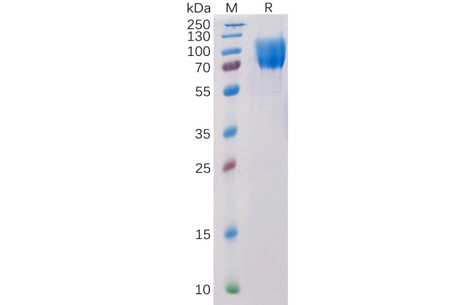 SDS-PAGE - Recombinant Human c-Kit Protein (6×His Tag) (A318217) - Antibodies.com
