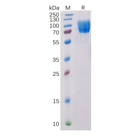 SDS-PAGE - Recombinant Human c-Kit Protein (6×His Tag) (A318217) - Antibodies.com