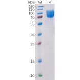 SDS-PAGE - Recombinant Human c-Kit Protein (6×His Tag) (A318217) - Antibodies.com