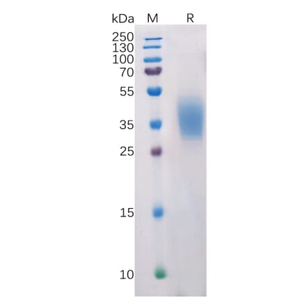 SDS-PAGE - Recombinant Human PD-L2 Protein (6×His Tag) (A318218) - Antibodies.com
