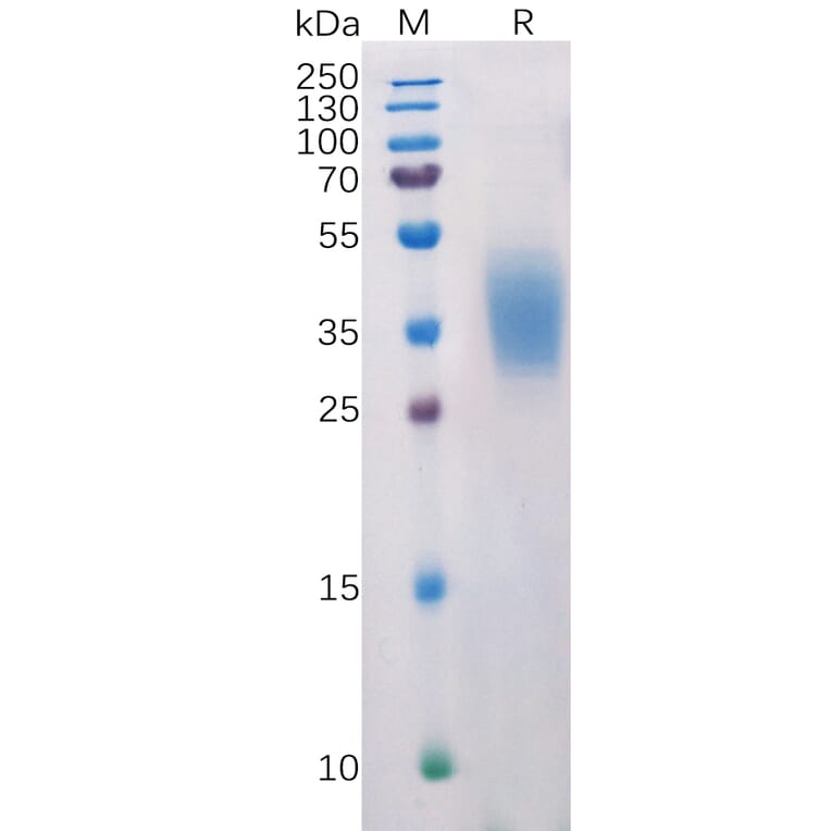 SDS-PAGE - Recombinant Human PD-L2 Protein (6×His Tag) (A318218) - Antibodies.com