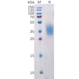 SDS-PAGE - Recombinant Human PD-L2 Protein (6×His Tag) (A318218) - Antibodies.com