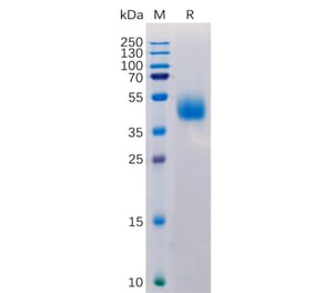 SDS-PAGE - Recombinant Human MICB Protein (6×His Tag) (A318220) - Antibodies.com