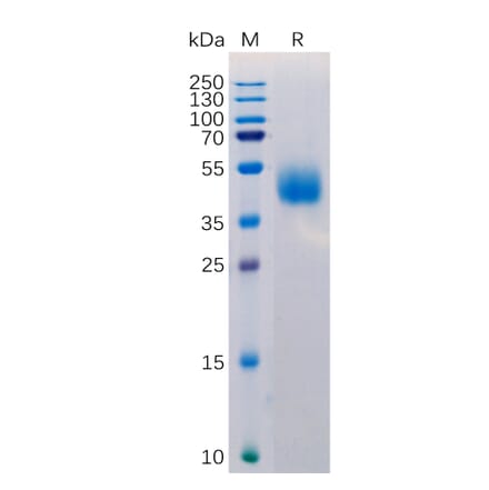 SDS-PAGE - Recombinant Human MICB Protein (6×His Tag) (A318220) - Antibodies.com