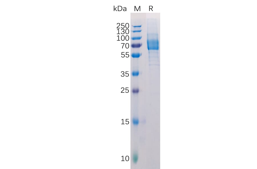 SDS-PAGE - Recombinant Human Galectin 9/Gal-9 Protein (Fc Tag) (A318221) - Antibodies.com