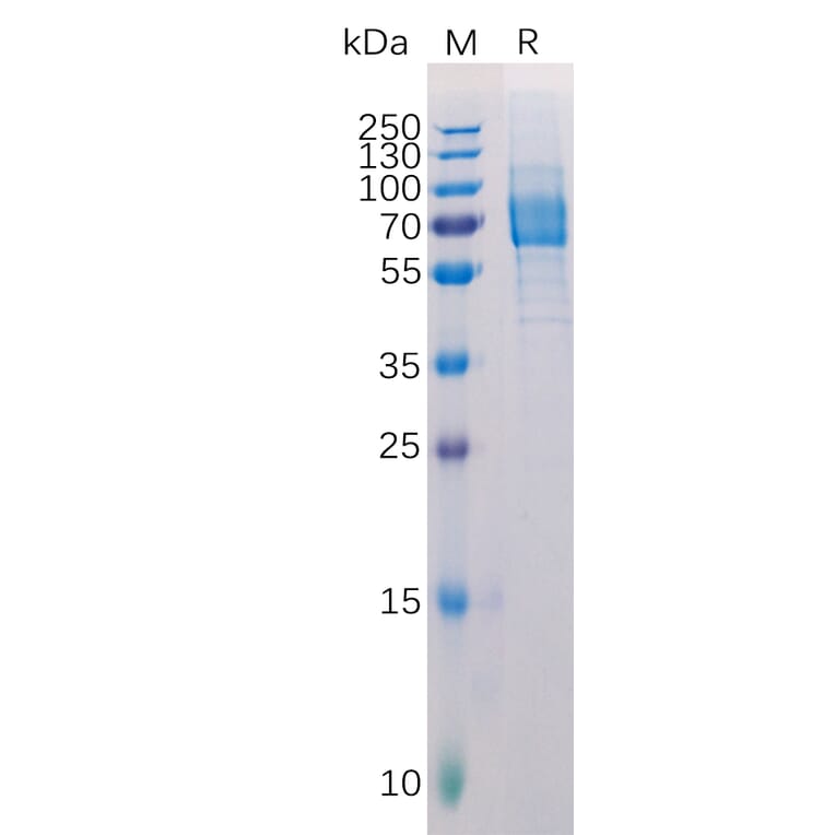 SDS-PAGE - Recombinant Human Galectin 9/Gal-9 Protein (Fc Tag) (A318221) - Antibodies.com