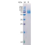SDS-PAGE - Recombinant Human Galectin 9/Gal-9 Protein (Fc Tag) (A318221) - Antibodies.com