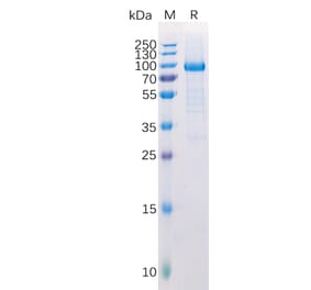 SDS-PAGE - Recombinant Human LAG-3 Protein (Fc Tag) (A318222) - Antibodies.com