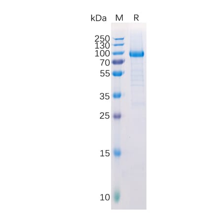 SDS-PAGE - Recombinant Human LAG-3 Protein (Fc Tag) (A318222) - Antibodies.com