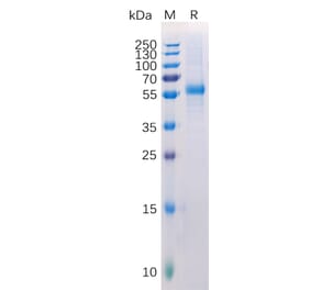 SDS-PAGE - Recombinant Human LAG-3 Protein (6×His Tag) (A318223) - Antibodies.com