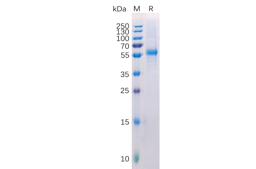 SDS-PAGE - Recombinant Human LAG-3 Protein (6×His Tag) (A318223) - Antibodies.com