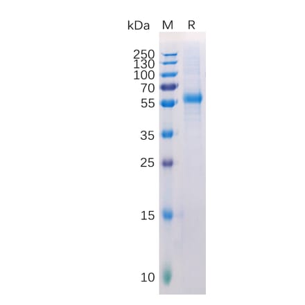 SDS-PAGE - Recombinant Human LAG-3 Protein (6×His Tag) (A318223) - Antibodies.com