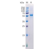 SDS-PAGE - Recombinant Human LAG-3 Protein (6×His Tag) (A318223) - Antibodies.com
