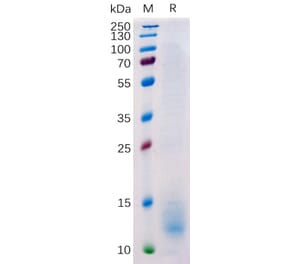 SDS-PAGE - Recombinant Human BCMA Protein (6×His Tag) (A318224) - Antibodies.com