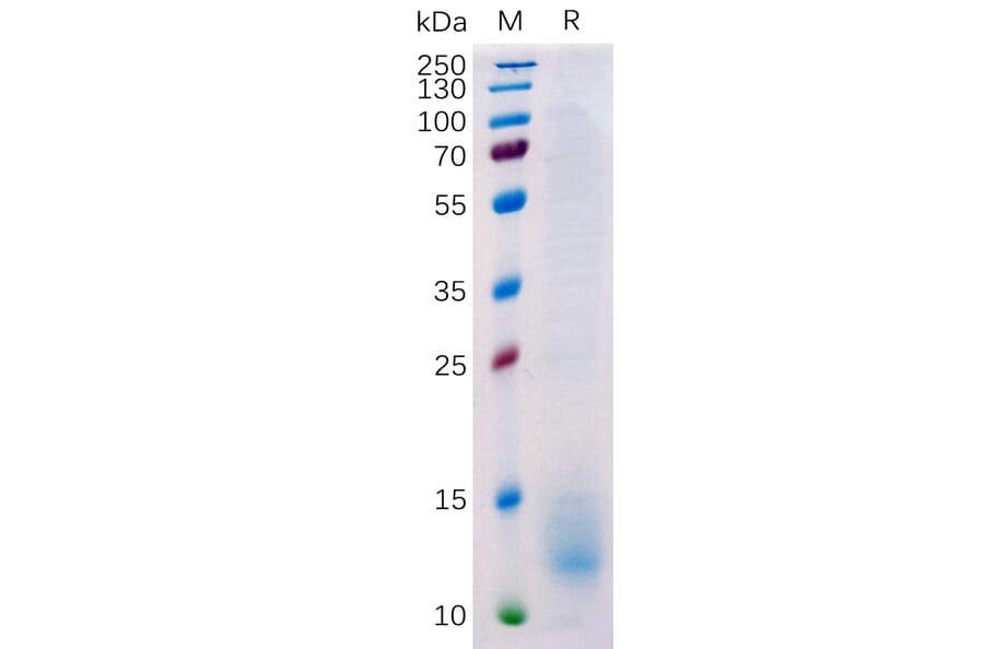 SDS-PAGE - Recombinant Human BCMA Protein (6×His Tag) (A318224) - Antibodies.com
