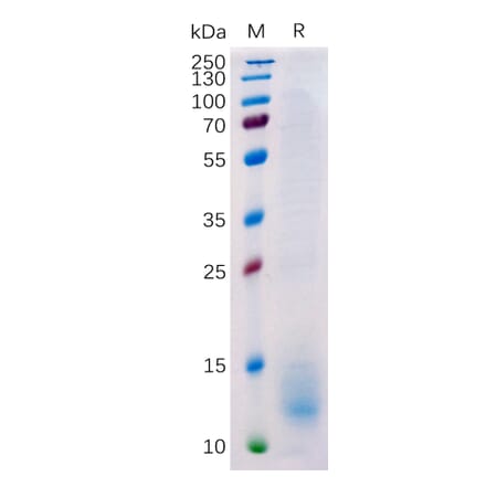 SDS-PAGE - Recombinant Human BCMA Protein (6×His Tag) (A318224) - Antibodies.com