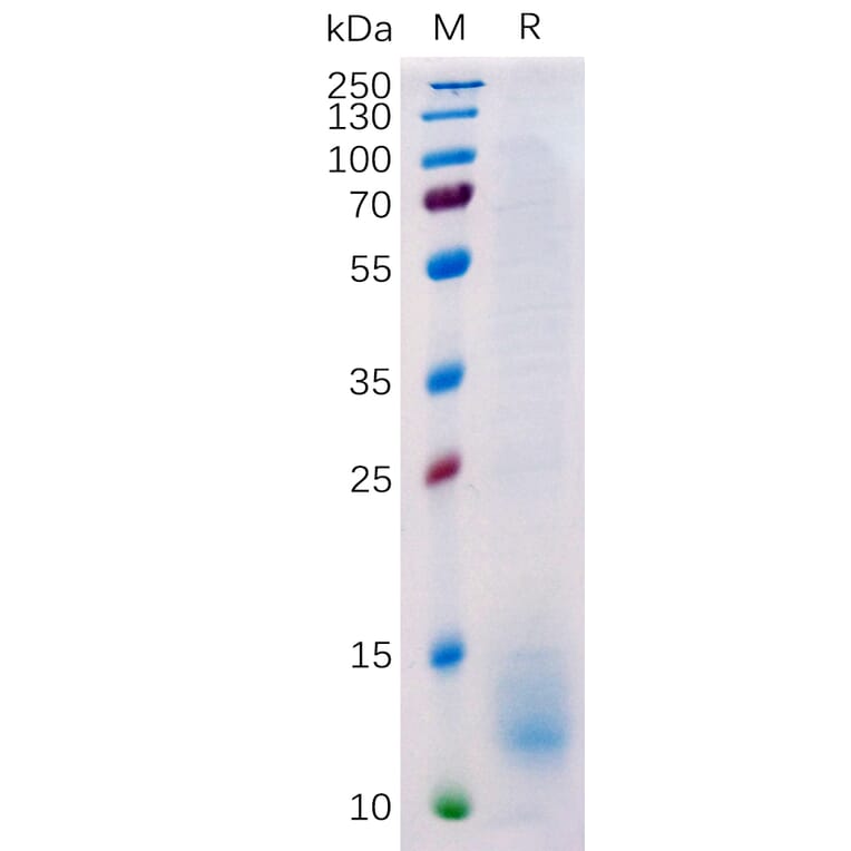 SDS-PAGE - Recombinant Human BCMA Protein (6×His Tag) (A318224) - Antibodies.com