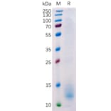 SDS-PAGE - Recombinant Human BCMA Protein (6×His Tag) (A318224) - Antibodies.com