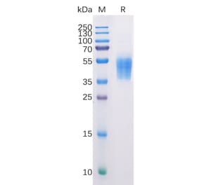 SDS-PAGE - Recombinant Human B7-H6 Protein (6×His Tag) (A318225) - Antibodies.com