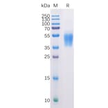 SDS-PAGE - Recombinant Human B7-H6 Protein (6×His Tag) (A318225) - Antibodies.com