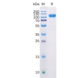 SDS-PAGE - Recombinant Human CD10 Protein (Fc Tag) (A318226) - Antibodies.com